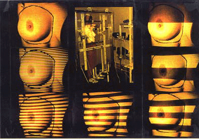 The CBM system (inset panel), surrounded by images of a breast with each of the coded light striping patterns projected onto it