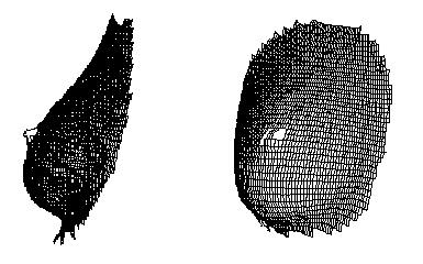 Three-dimensional topographic maps of a breast
